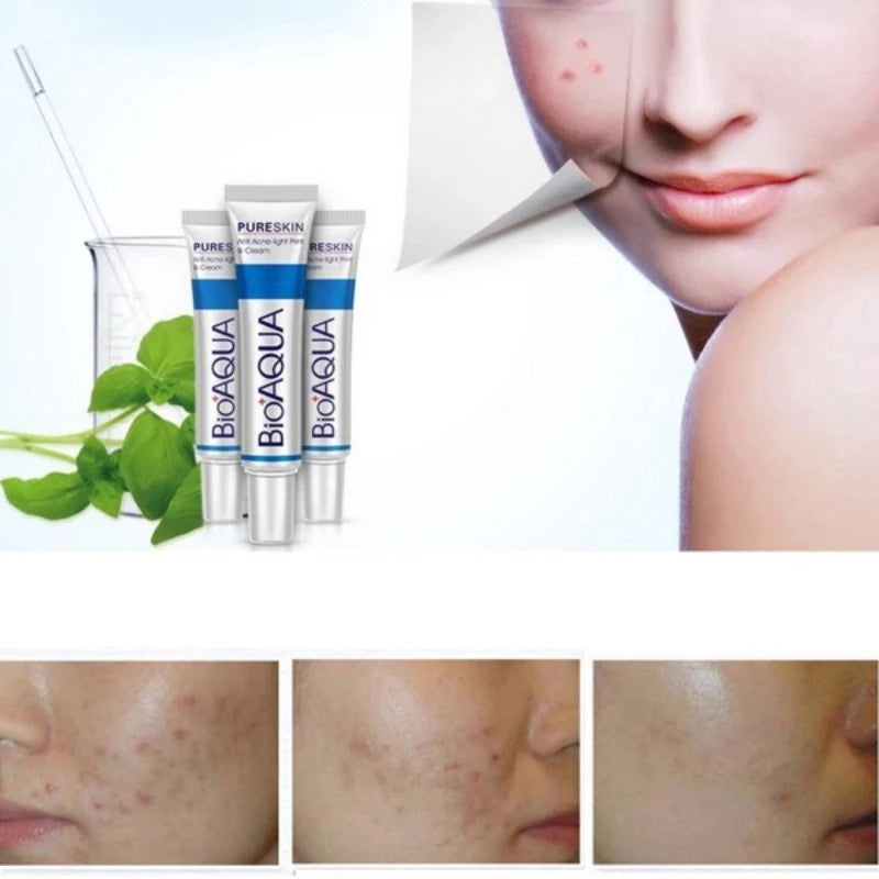 CREMA ANTIACNE ESPINILLA BIOAQUA